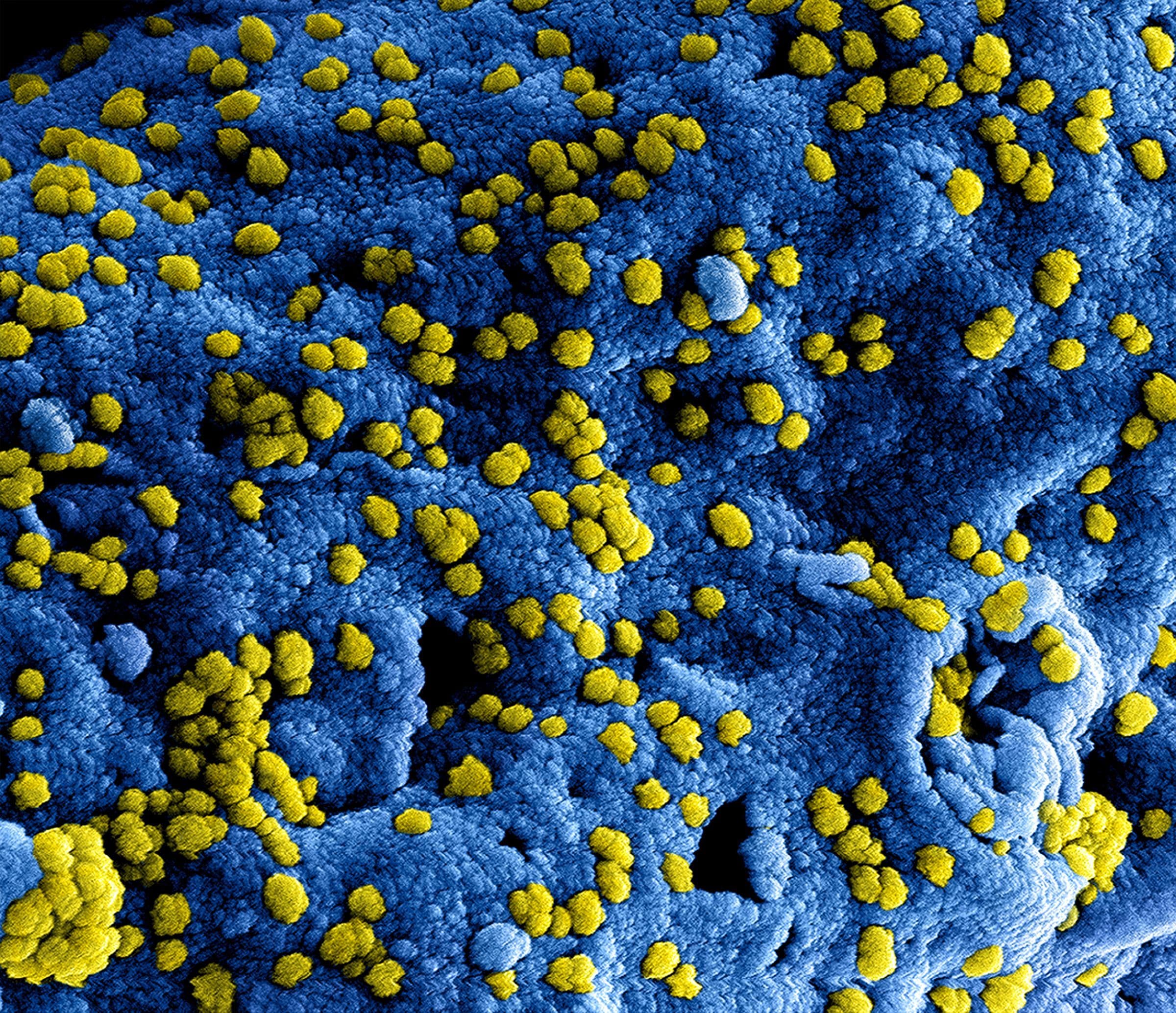 Monkeypox Ghana: What You Need to Know