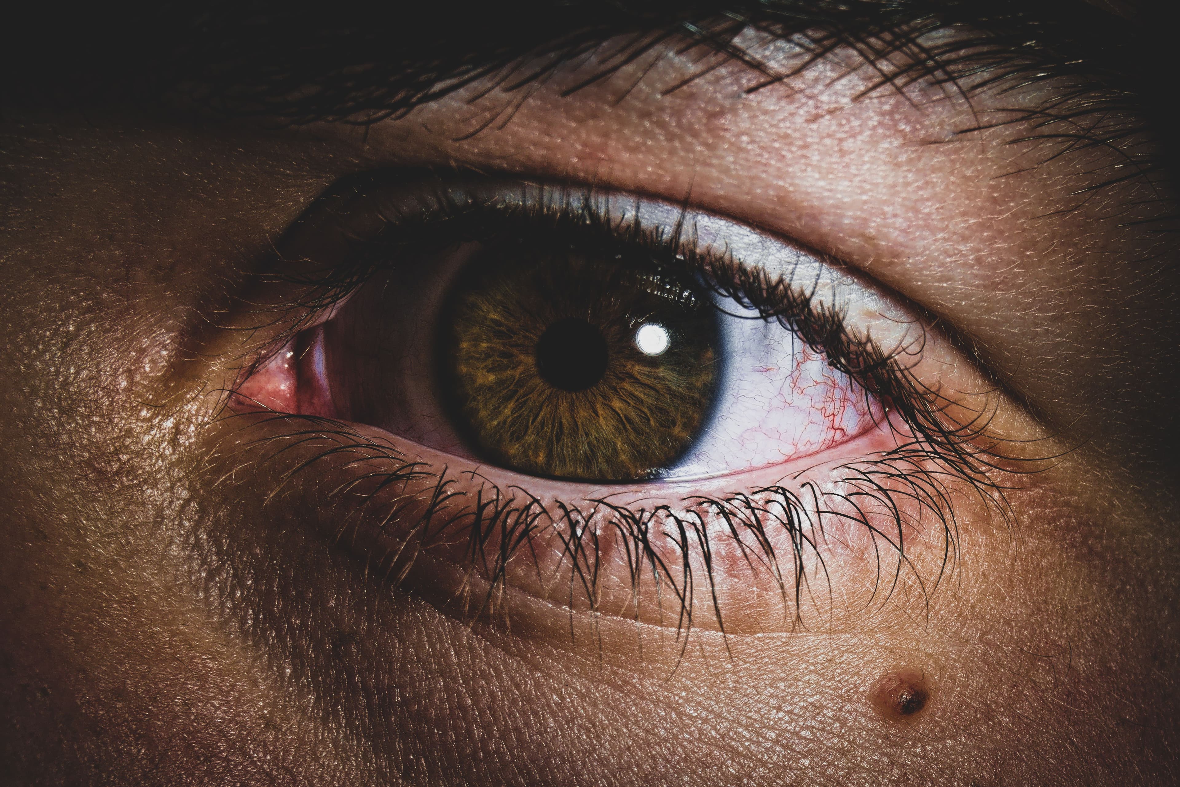 How to Cure Apollo Eye Disease Fast?